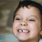 Il Bambino Digrigna i Denti: Cosa Fare?