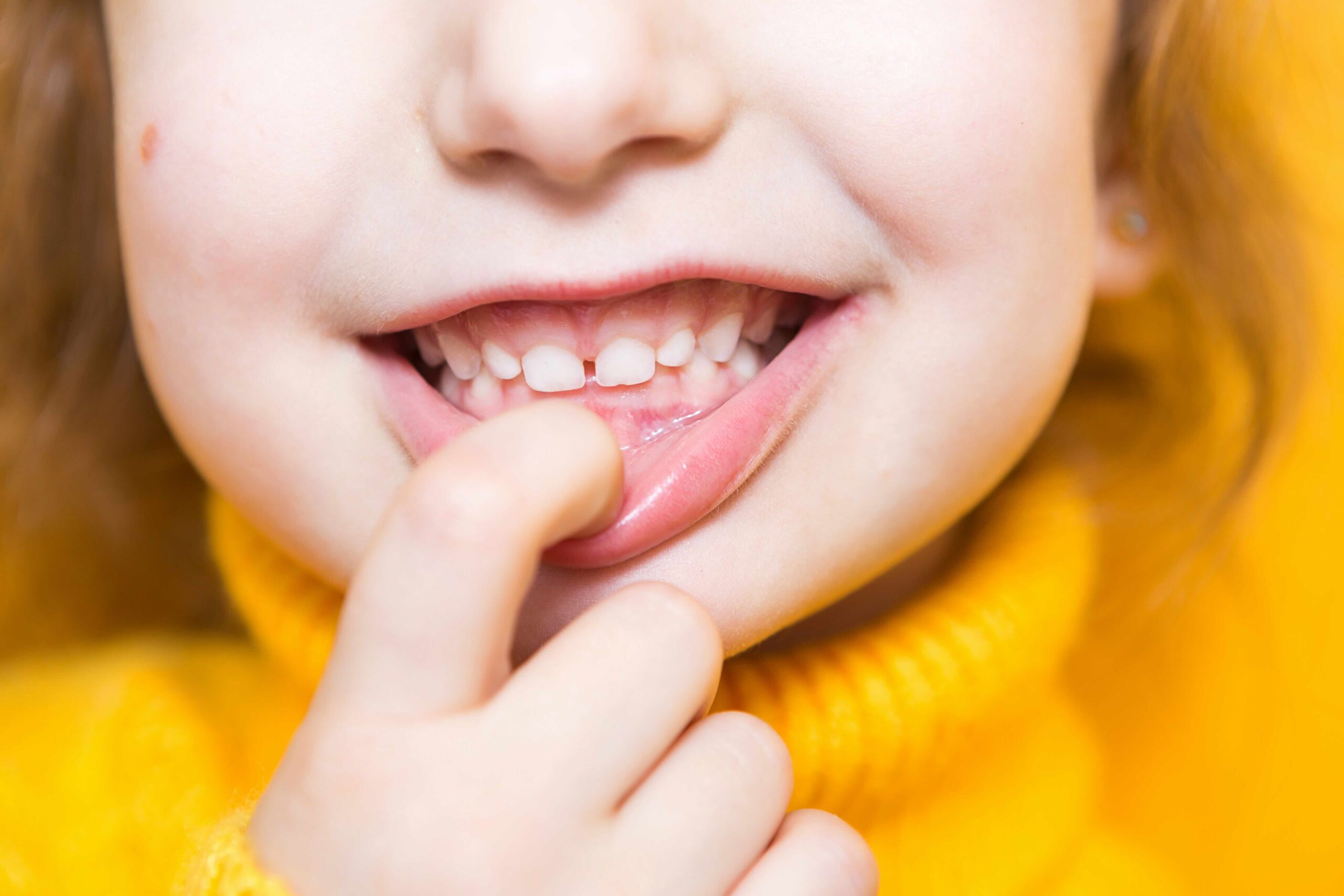 Importanza del Controllo Ortodontico Precoce nei Bambini